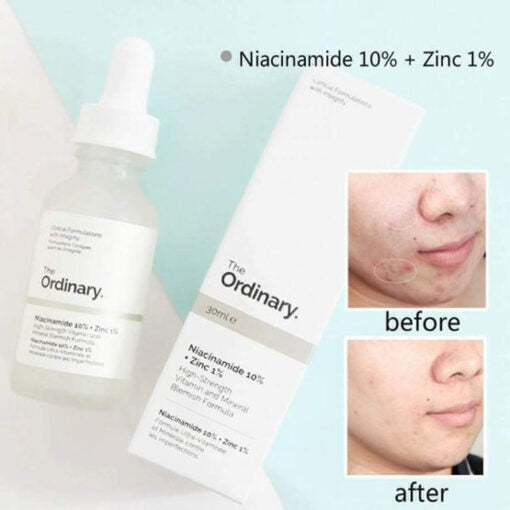 The Ordinary Niacinamide 10% + Zinc 1%  30ml